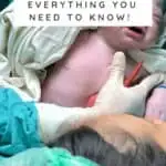 C-Section For Plus Size Women Everything You Need To Know!
