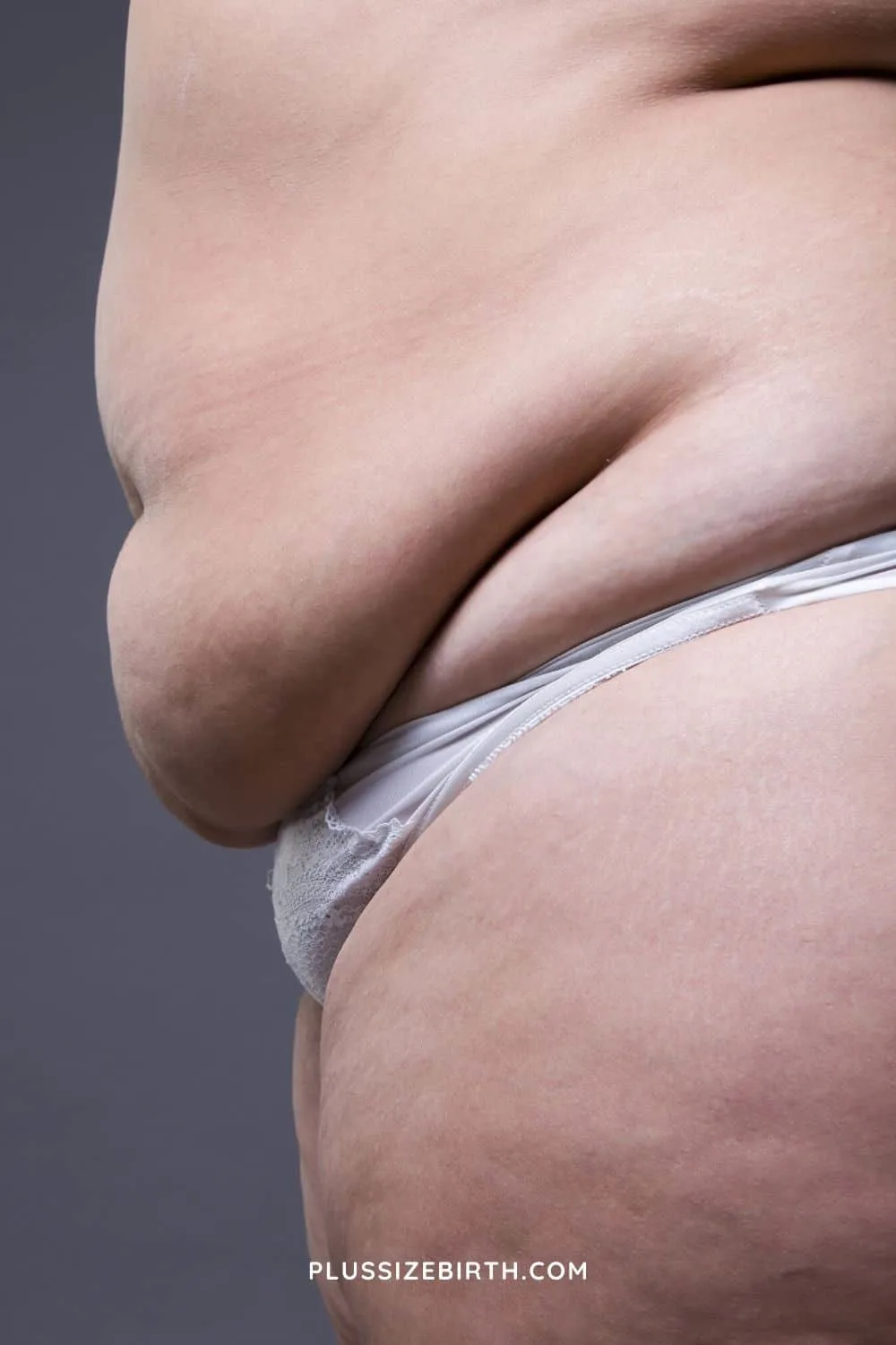 Hanging Belly Fat. Folds On The Abdomen. Women Sagging Skin. To