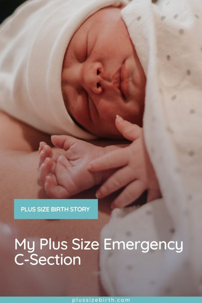 Plus Size Emergency C-Section mom with baby 