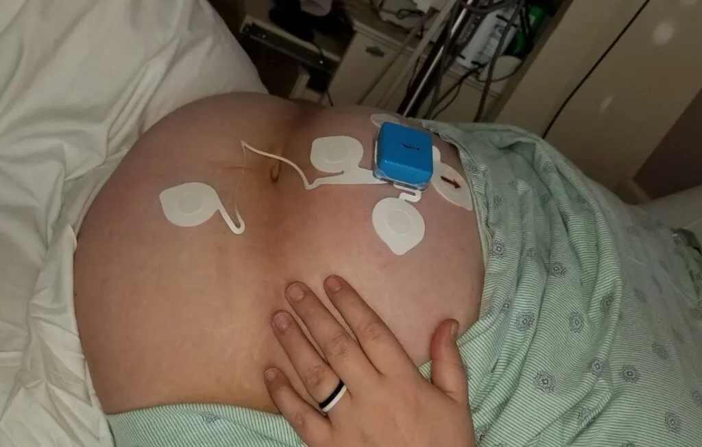Novii wireless monitoring obese woman