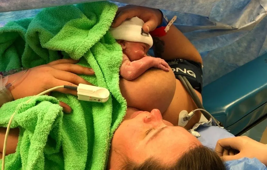 obese woman cesarean birth