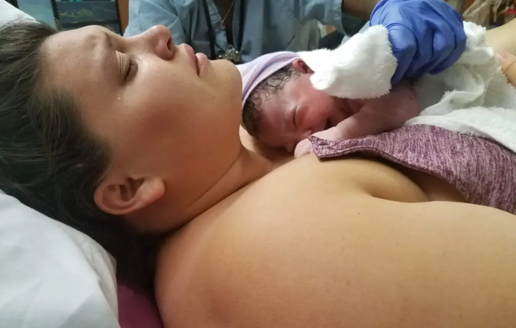 obese woman giving birth