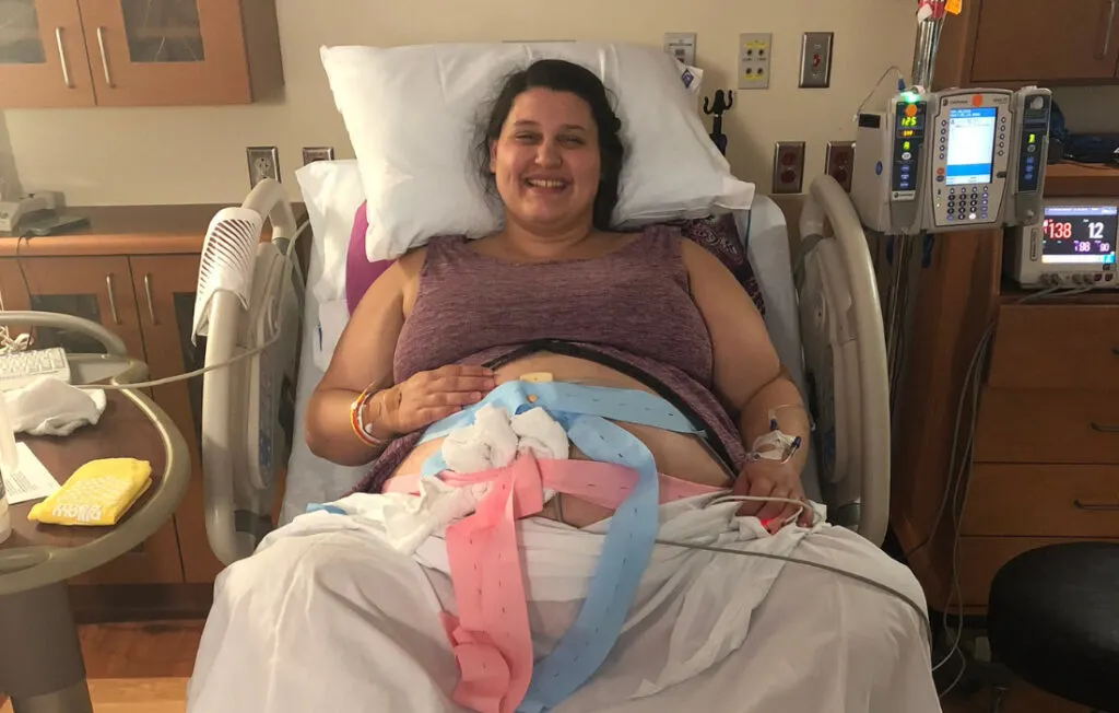 plus size woman Monitoring During Labor 