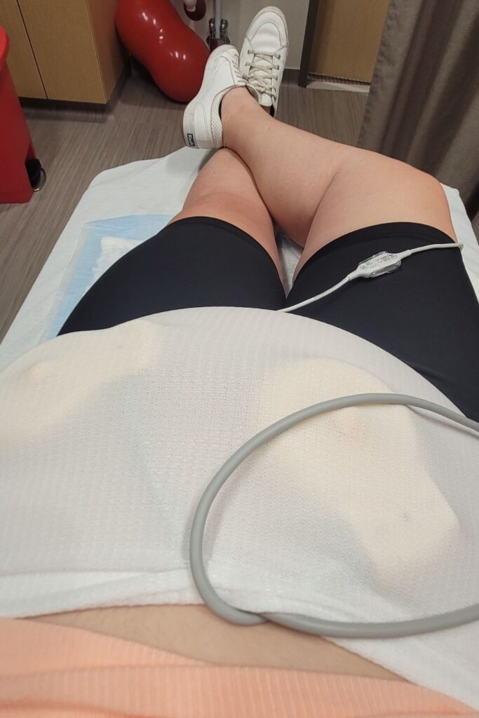 belly band during pregnancy monitoring