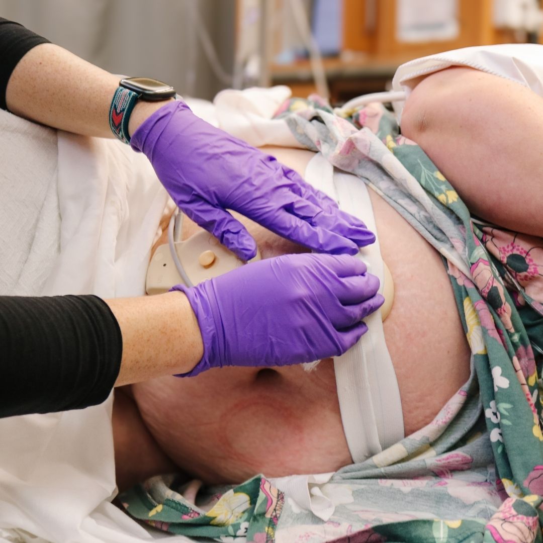 plus size pregnant woman having fetal monitoring during labor